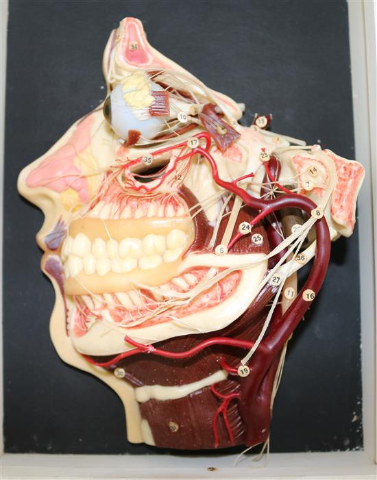 A Mittelwerk wax medical model of the internal workings of a human head, 9.5in.